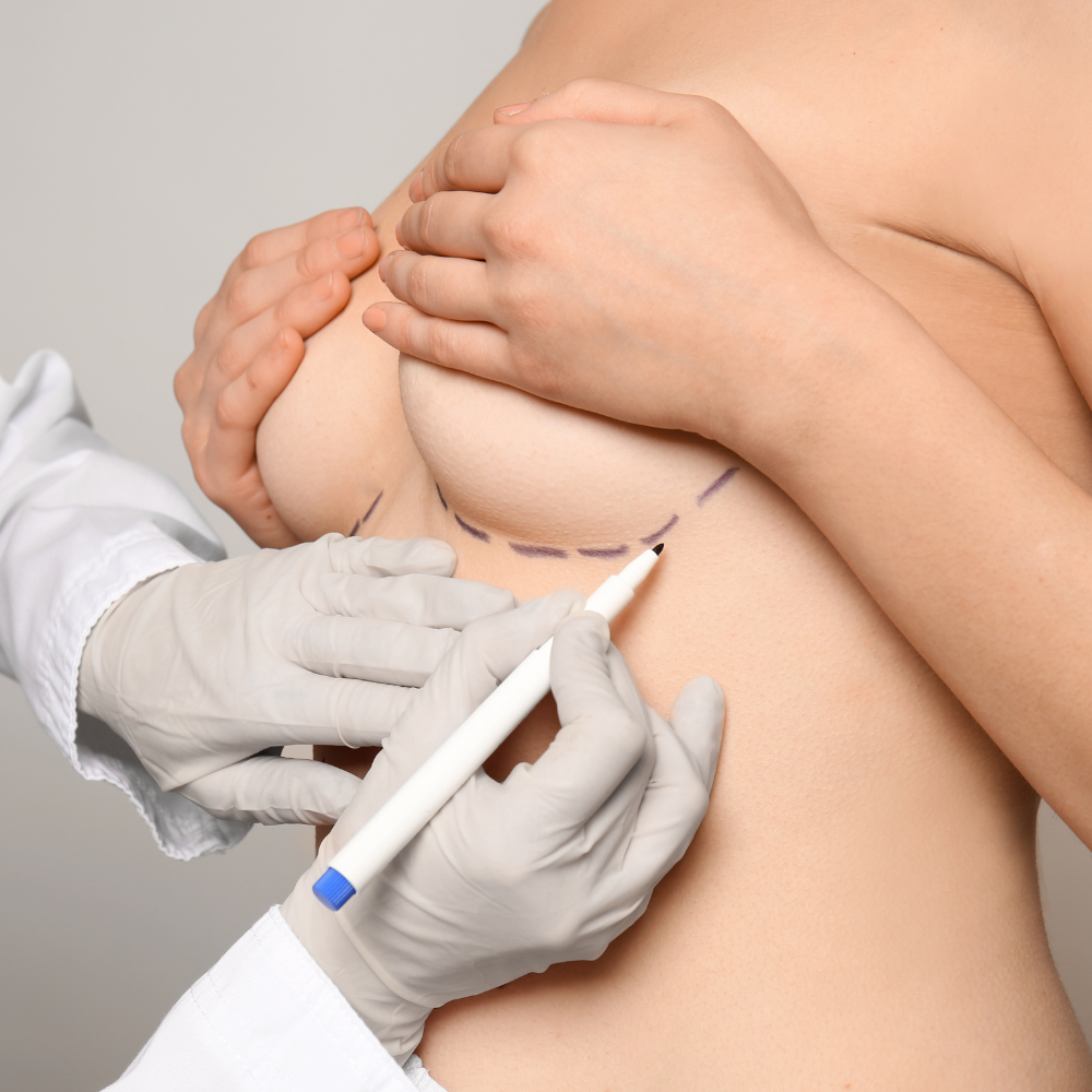 augmentation-mammaire-graisse-3