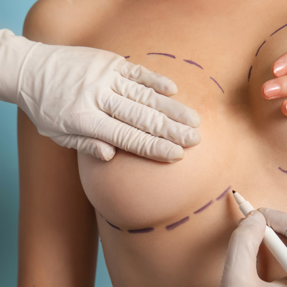 retrait-implant-2